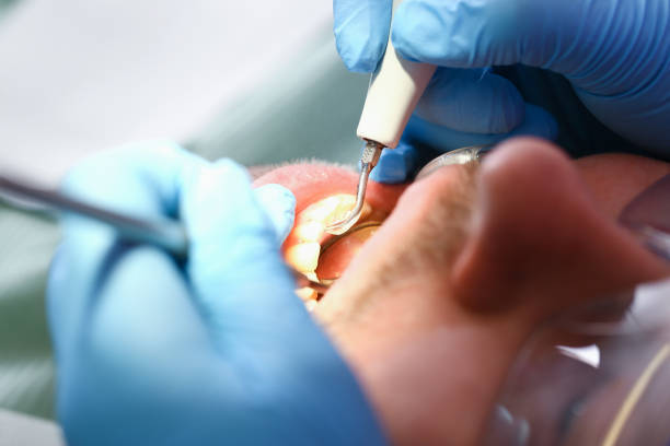Best Teeth Whitening  in Holcom, KS