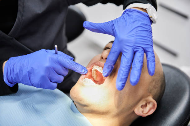 Best Chipped Tooth Repair Near Me  in Holcom, KS